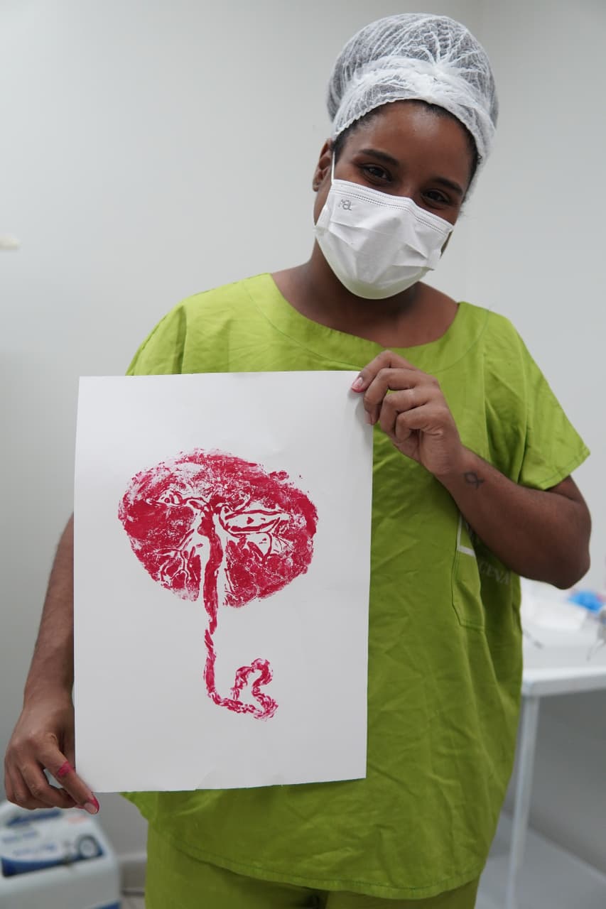 Profissional segurando impressão da placenta em tinta vermelha